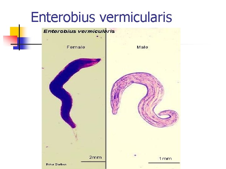 Enterobius vermicularis 