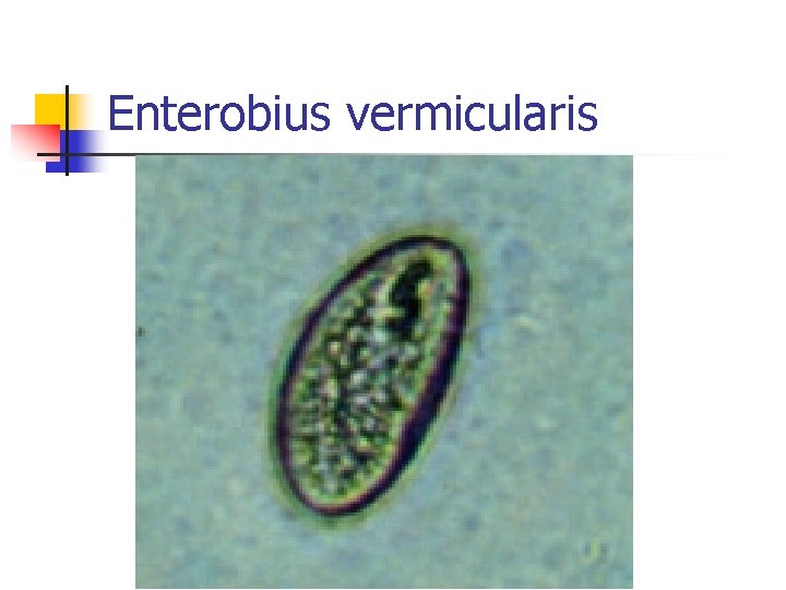 Enterobius vermicularis 