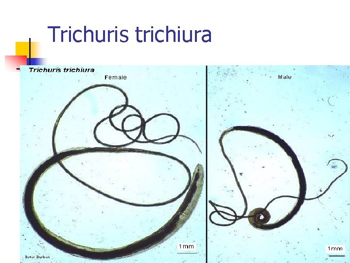 Trichuris trichiura 