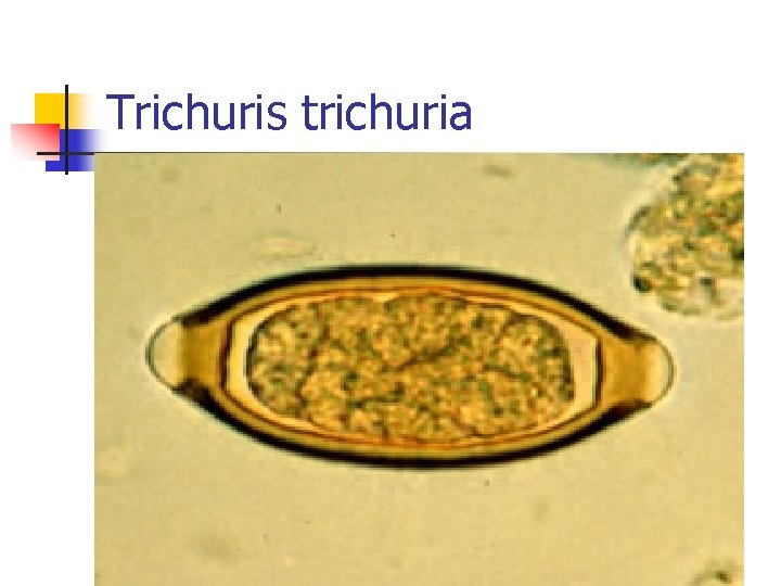 Trichuris trichuria 