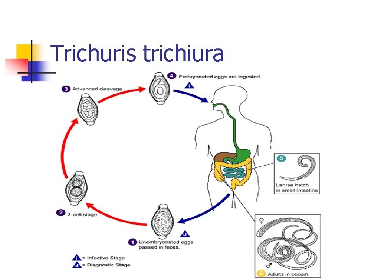 Trichuris trichiura 