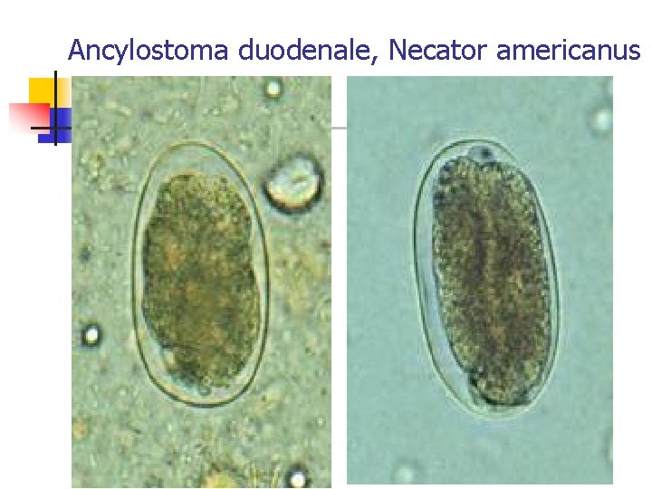 Ancylostoma duodenale, Necator americanus 