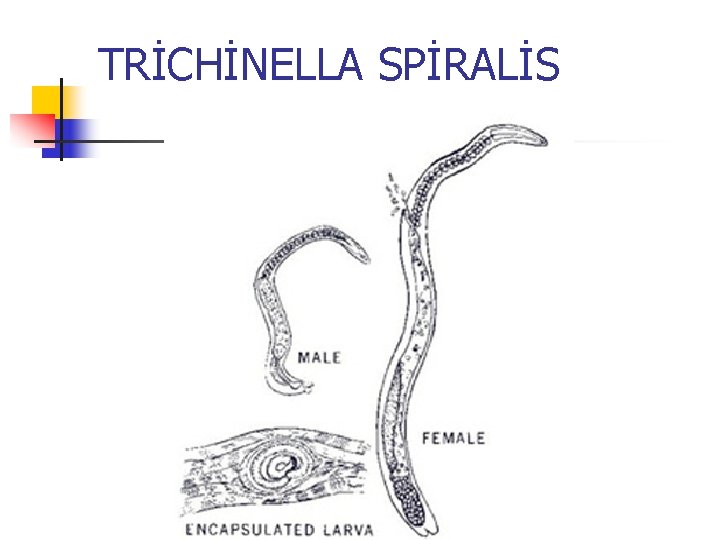 TRİCHİNELLA SPİRALİS 
