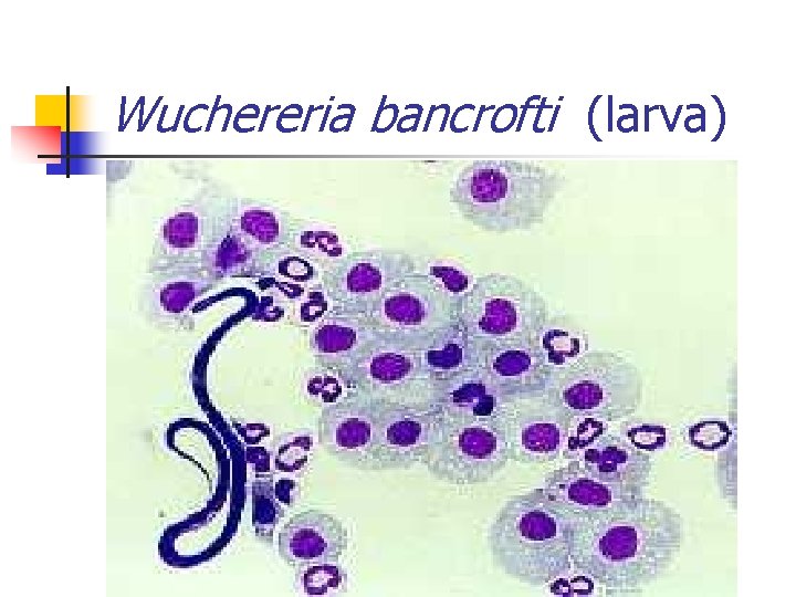 Wuchereria bancrofti (larva) 
