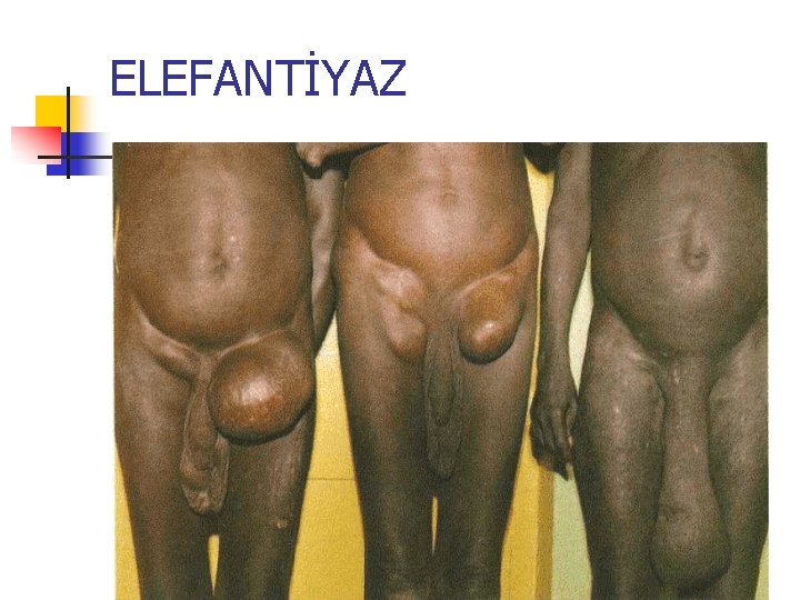 ELEFANTİYAZ 