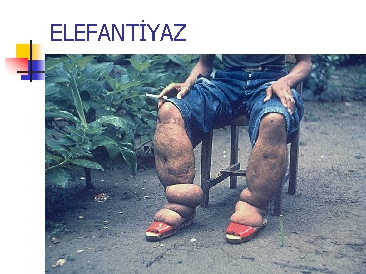 ELEFANTİYAZ 
