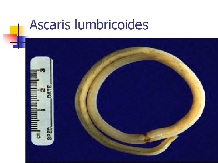 Ascaris lumbricoides 