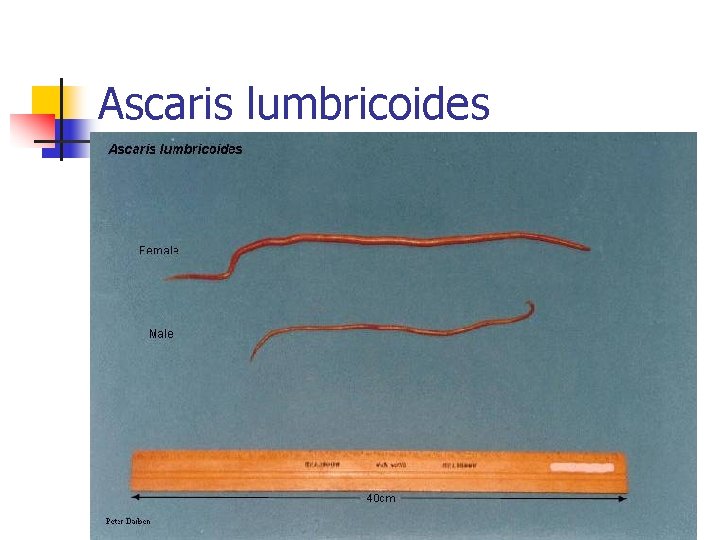 Ascaris lumbricoides 