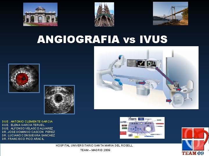 ANGIOGRAFIA vs IVUS DUE. ANTONIO CLEMENTE GARCIA DUE. ELENA GARCIA TERUEL. DUE. ALFONSO VELASCO