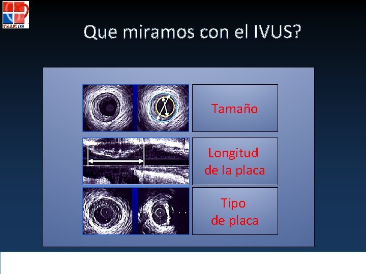 Que miramos con el IVUS? Tamaño Longitud de la placa Tipo de placa 