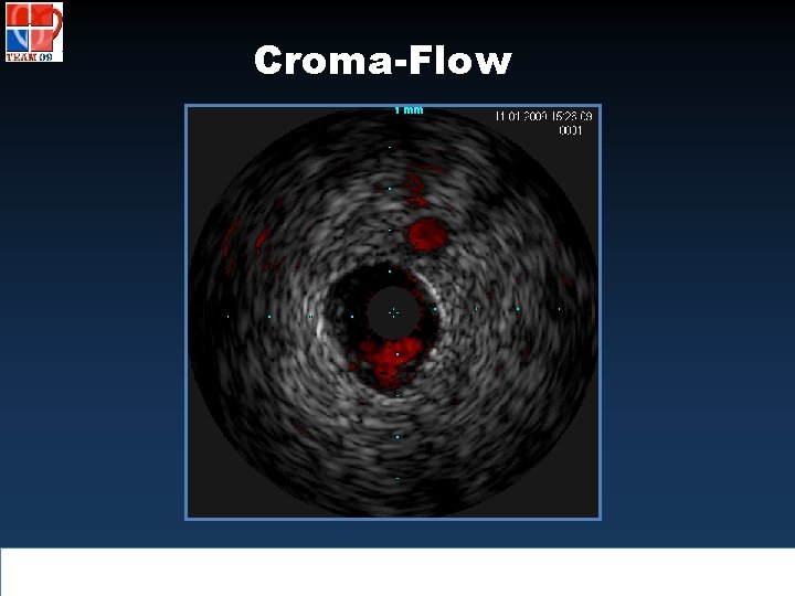 Croma-Flow 