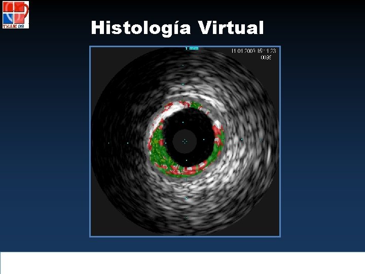 Histología Virtual 