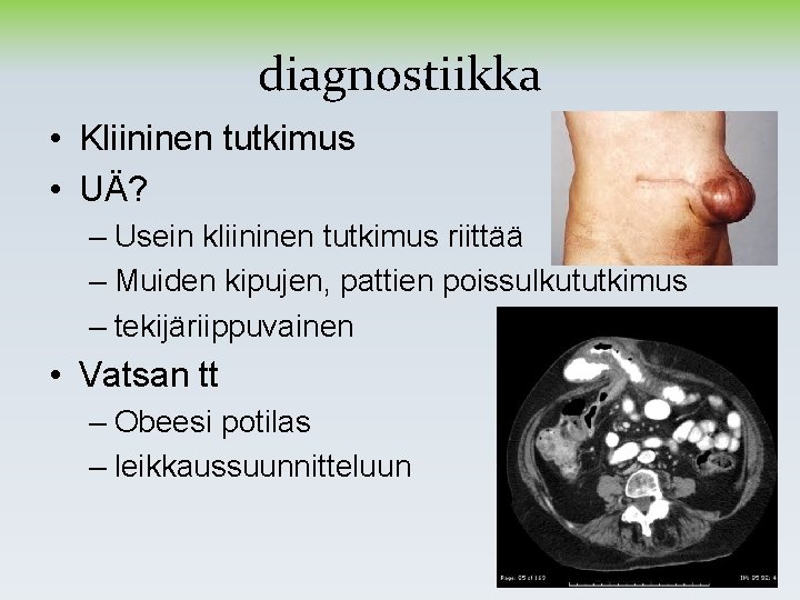 diagnostiikka • Kliininen tutkimus • UÄ? – Usein kliininen tutkimus riittää – Muiden kipujen, diagnostiikka • Kliininen tutkimus • UÄ? – Usein kliininen tutkimus riittää – Muiden kipujen,