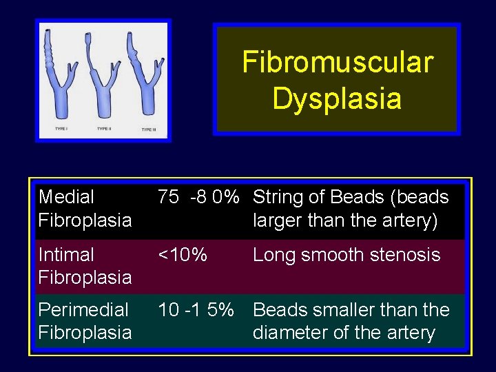 Fibromuscular Dysplasia Medial Fibroplasia 75 -8 0% String of Beads (beads larger than the