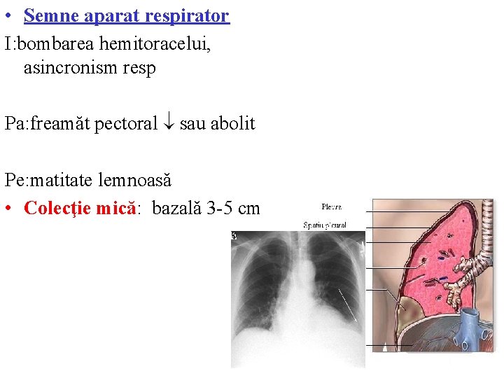  • Semne aparat respirator I: bombarea hemitoracelui, asincronism resp Pa: freamăt pectoral sau
