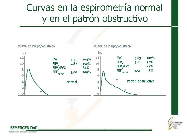 Curvas en la espirometría normal y en el patrón obstructivo 