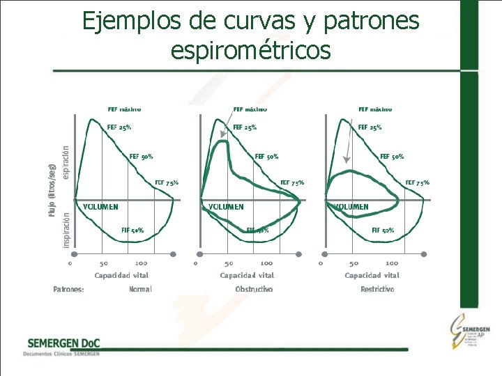 Ejemplos de curvas y patrones espirométricos 