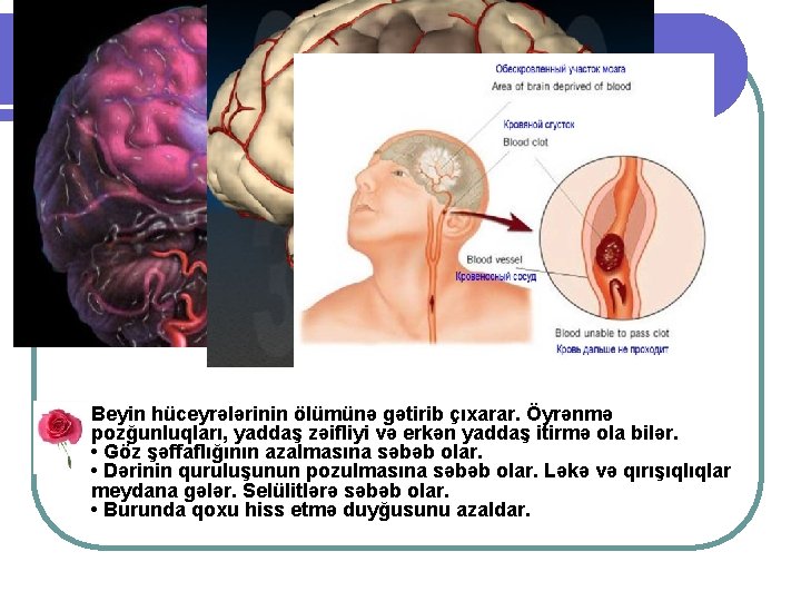 l Beyin hüceyrələrinin ölümünə gətirib çıxarar. Öyrənmə pozğunluqları, yaddaş zəifliyi və erkən yaddaş itirmə