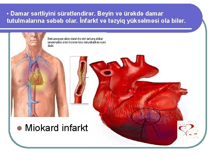  • Damar sərtliyini sürətləndirər. Beyin və ürəkdə damar tutulmalarına səbəb olar. İnfarkt və