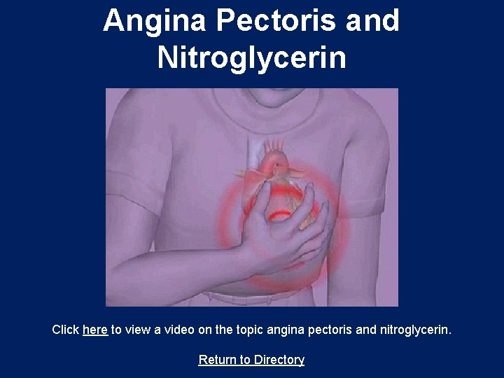Angina Pectoris and Nitroglycerin Click here to view a video on the topic angina
