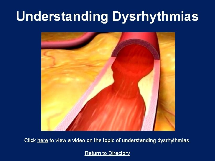 Understanding Dysrhythmias Click here to view a video on the topic of understanding dysrhythmias.