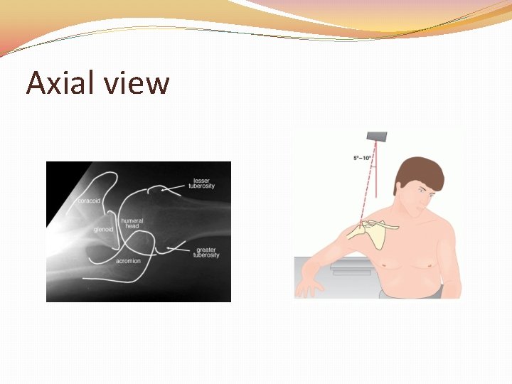 Axial view 