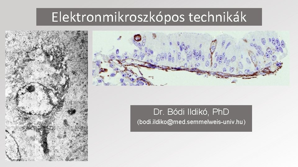 Elektronmikroszkópos technikák Dr. Bódi Ildikó, Ph. D (bodi. ildiko@med. semmelweis-univ. hu) 