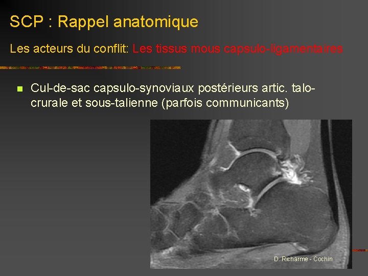 SCP : Rappel anatomique Les acteurs du conflit: Les tissus mous capsulo-ligamentaires n Cul-de-sac