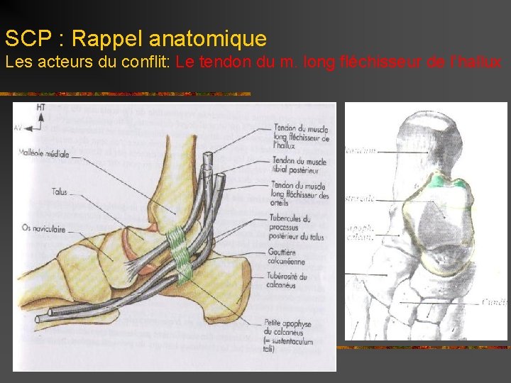 SCP : Rappel anatomique Les acteurs du conflit: Le tendon du m. long fléchisseur