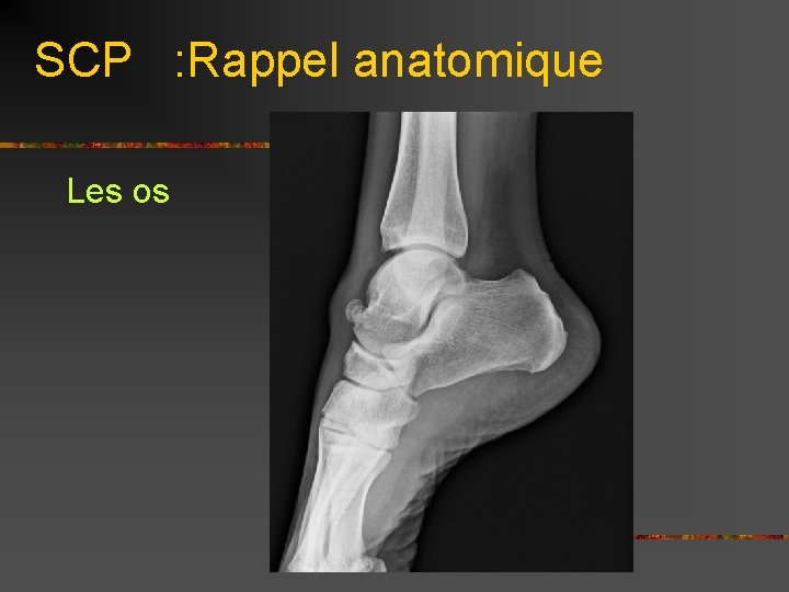 SCP : Rappel anatomique Les os 