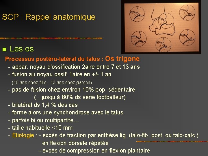 SCP : Rappel anatomique n Les os Processus postéro-latéral du talus : Os trigone