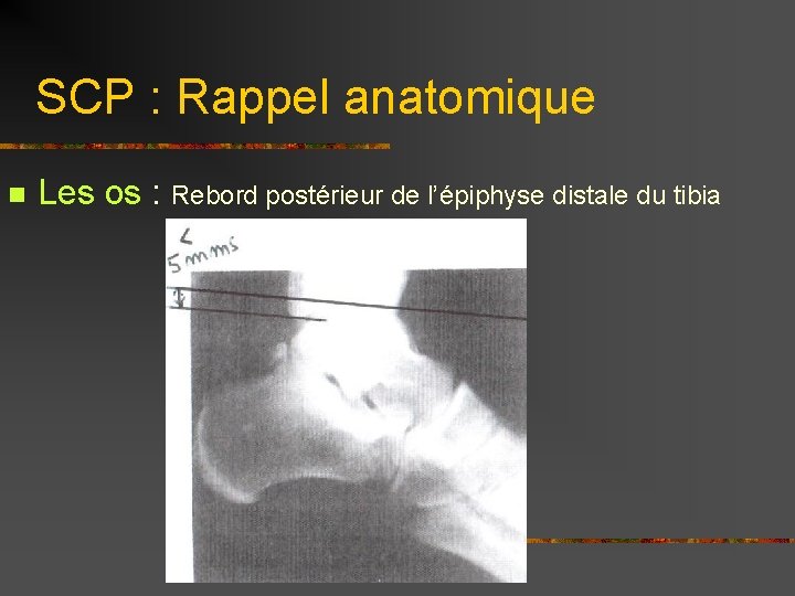 SCP : Rappel anatomique n Les os : Rebord postérieur de l’épiphyse distale du