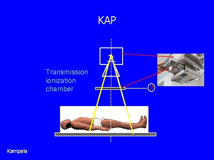 KAP Transmission ionization chamber Kampala 