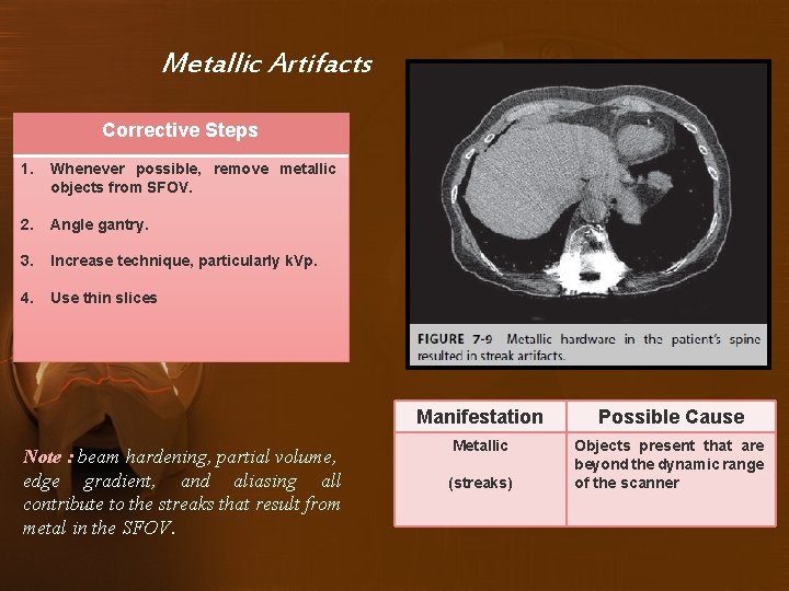 Metallic Artifacts Corrective Steps 1. Whenever possible, remove metallic objects from SFOV. 2. Angle