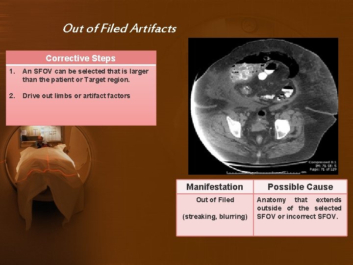 Out of Filed Artifacts Corrective Steps 1. An SFOV can be selected that is