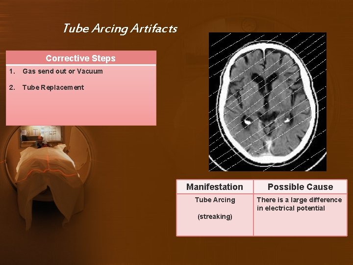 Tube Arcing Artifacts Corrective Steps 1. Gas send out or Vacuum 2. Tube Replacement