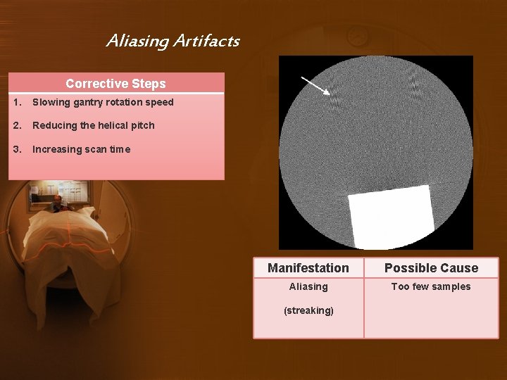 Aliasing Artifacts Corrective Steps 1. Slowing gantry rotation speed 2. Reducing the helical pitch
