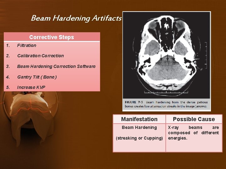 Beam Hardening Artifacts Corrective Steps 1. Filtration 2. Calibration Correction 3. Beam Hardening Correction