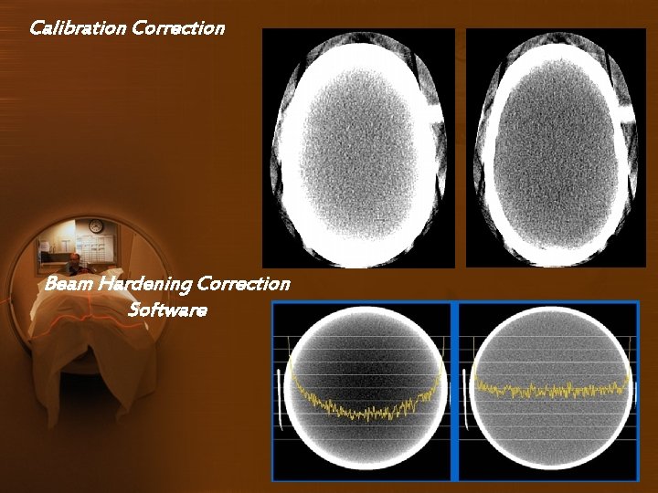 Calibration Correction Beam Hardening Correction Software 