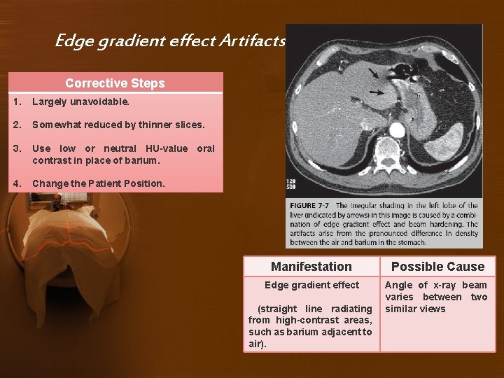 Edge gradient effect Artifacts Corrective Steps 1. Largely unavoidable. 2. Somewhat reduced by thinner