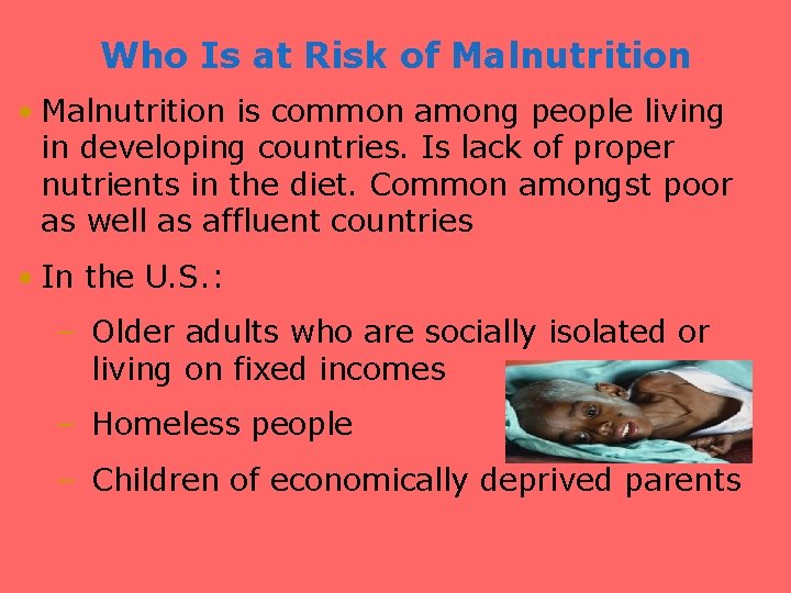 Who Is at Risk of Malnutrition • Malnutrition is common among people living in
