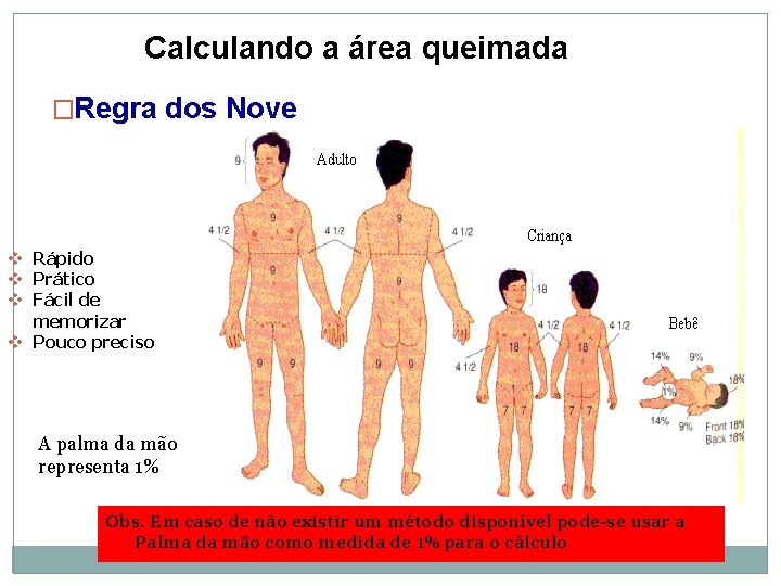 Calculando a área queimada �Regra dos Nove v Rápido v Prático v Fácil de