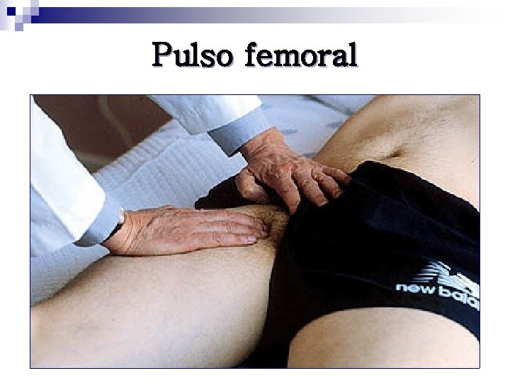 Pulso femoral 
