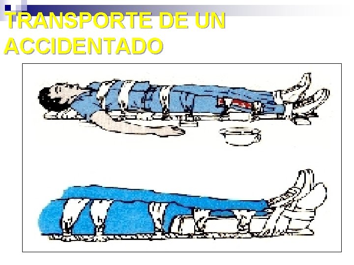 TRANSPORTE DE UN ACCIDENTADO 