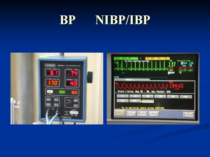 BP NIBP/IBP 