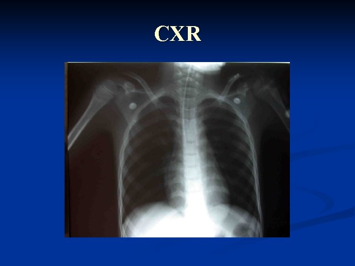 CXR 