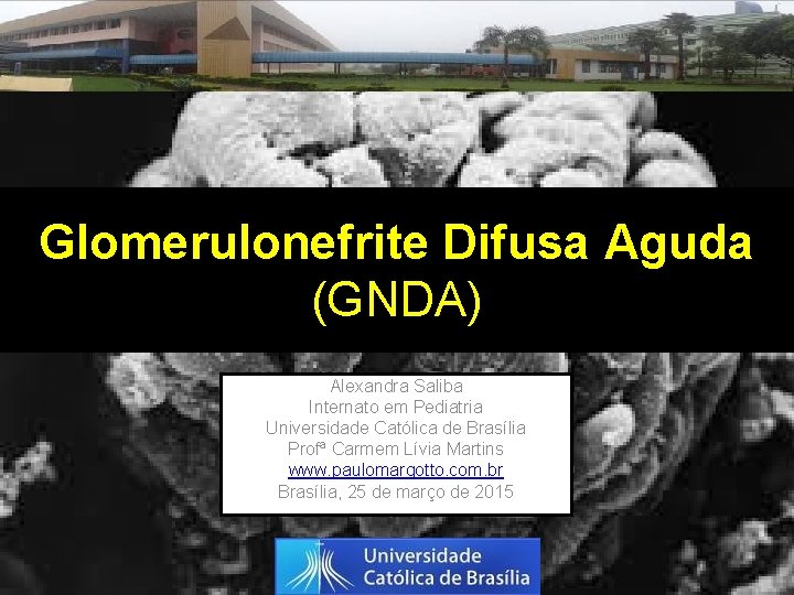 Glomerulonefrite Difusa Aguda (GNDA) Alexandra Saliba Internato em Pediatria Universidade Católica de Brasília Profª