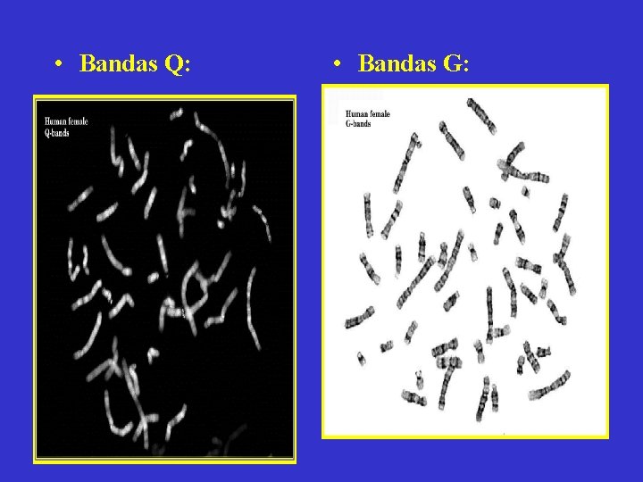 • Bandas Q: • Bandas G: • Bandas Q: • Bandas G: