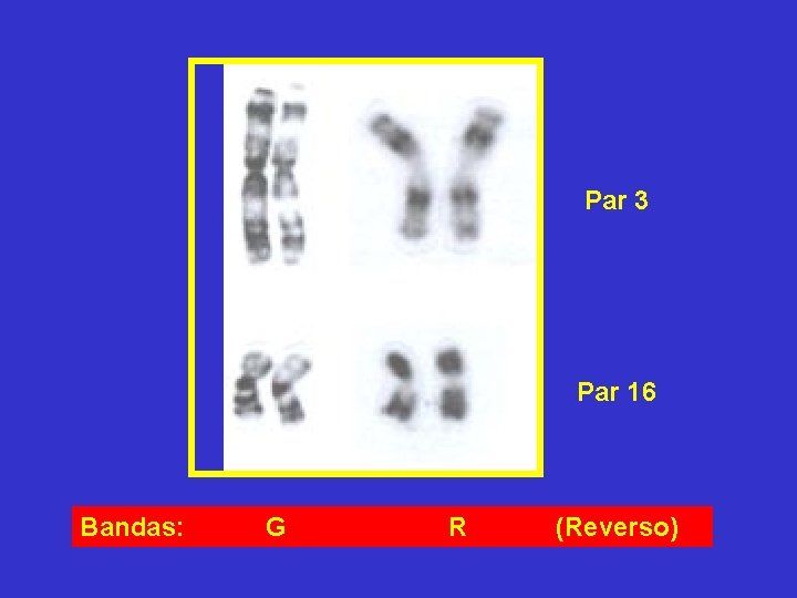 Par 3 Par 16 Bandas: G R (Reverso) Par 3 Par 16 Bandas: G R (Reverso)