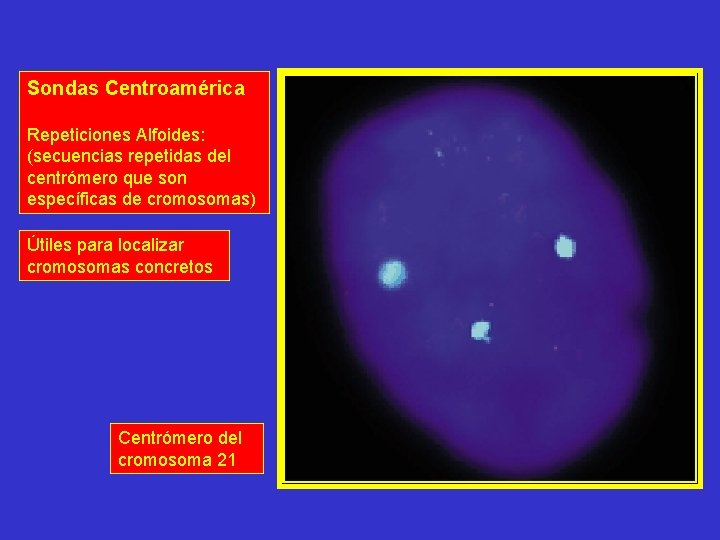 Sondas Centroamérica Repeticiones Alfoides: (secuencias repetidas del centrómero que son específicas de cromosomas) Útiles Sondas Centroamérica Repeticiones Alfoides: (secuencias repetidas del centrómero que son específicas de cromosomas) Útiles
